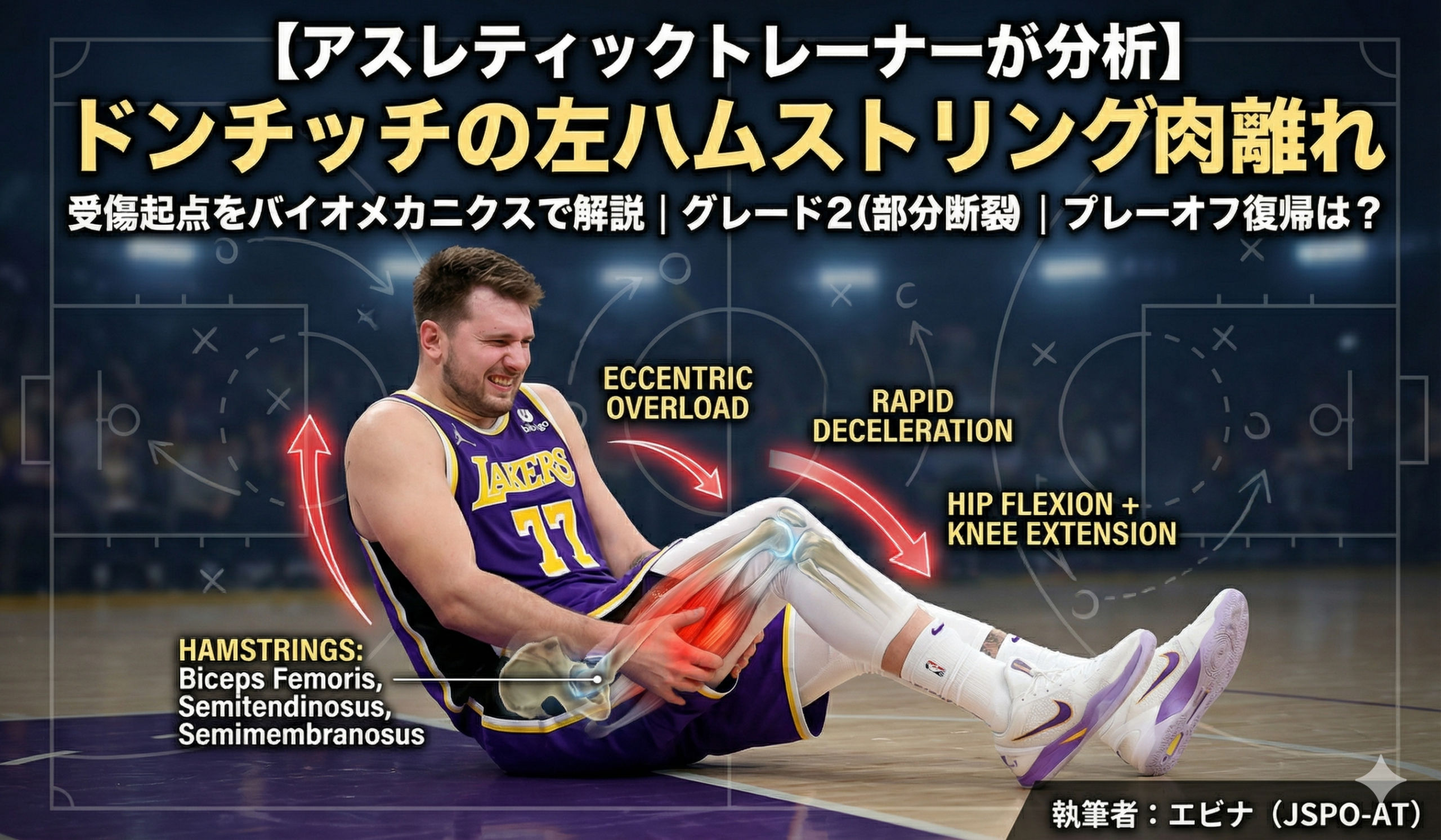 NBAレイカーズのルカ・ドンチッチ選手（背番号77）が、コート上で左ハムストリングを痛めてしゃがみ込む様子。その上に、骨格と筋肉の図解が重ねられ、ハムストリング筋群の損傷部位（赤い光）と、怪我の要因となった力学的ストレス（「ECCENTRIC OVERLOAD」「RAPID DECELERATION」「HIP FLEXION + KNEE EXTENSION」などの英語技術用語）を示す赤い矢印が表示されている。上部には「【アスレティックトレーナーが分析】ドンチッチの左ハムストリング肉離れ」という日本語のタイトルと、怪我の詳細（グレード2、プレーオフ復帰は？）が書かれている。右下には「執筆者: エビナ (JSPO-AT)」とある。背景は戦術ボードの図とぼかされたNBAアリーナ。